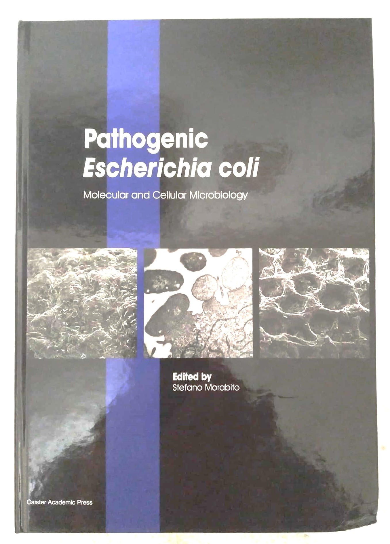 Pathogenic Escherichia coli: Molecular and Cellular Microbiology